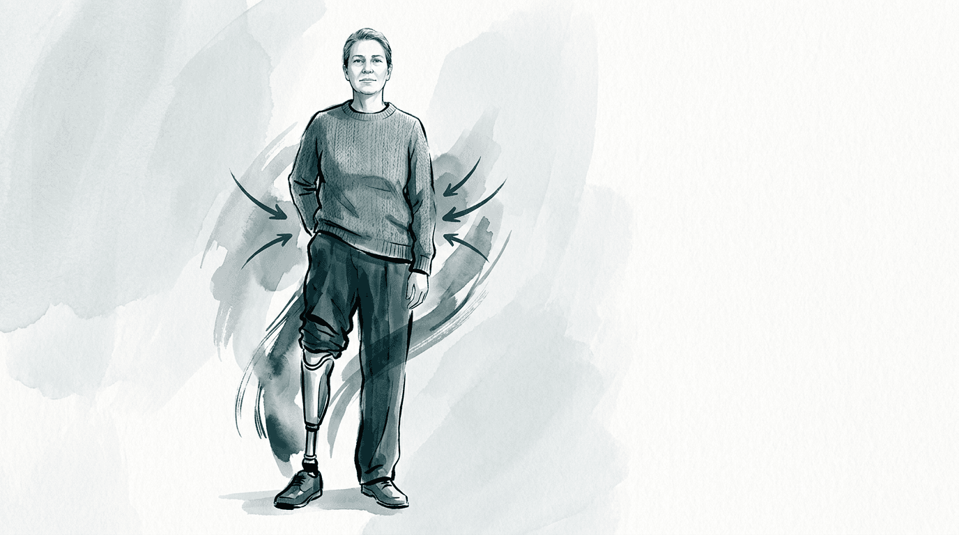 Illustrazione editoriale: amputazione transtibiale destra e lombalgia da compenso pelvico