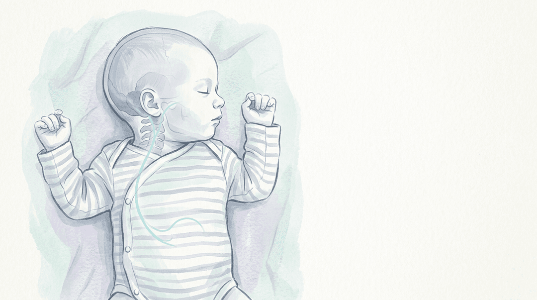 Illustrazione editoriale delicata: coliche infantili, compressione condilare percepita e ipotesi vagale