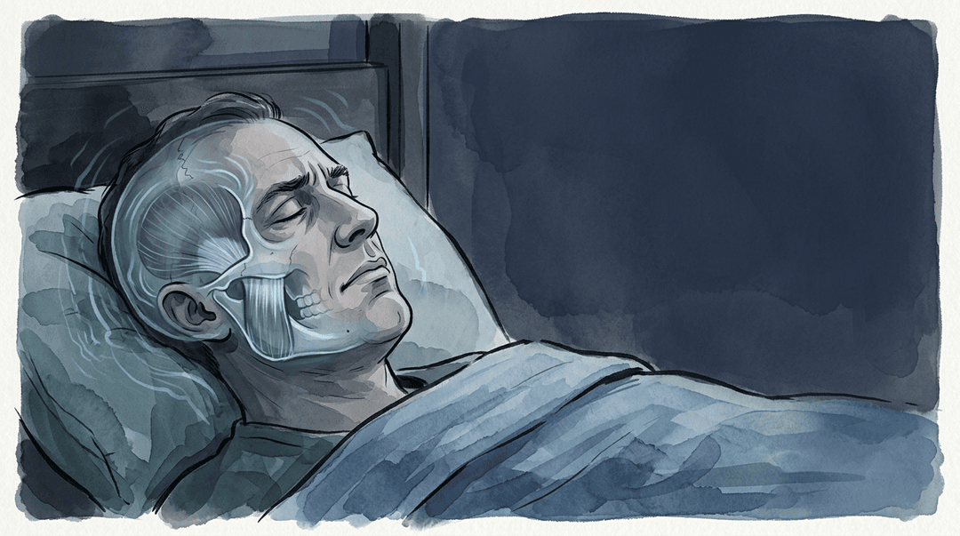 Illustrazione editoriale: bruxismo notturno, disfunzione sfeno-temporale e componente ansiosa