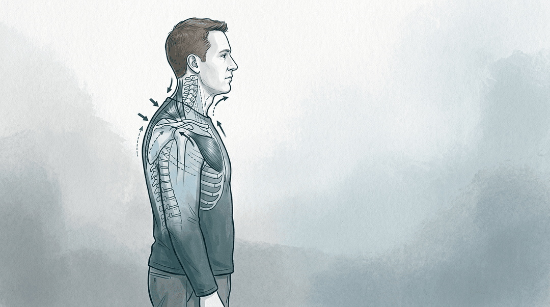 Illustrazione editoriale: cervicalgia cronica con schema a croce superiore e alterazioni posturali globali