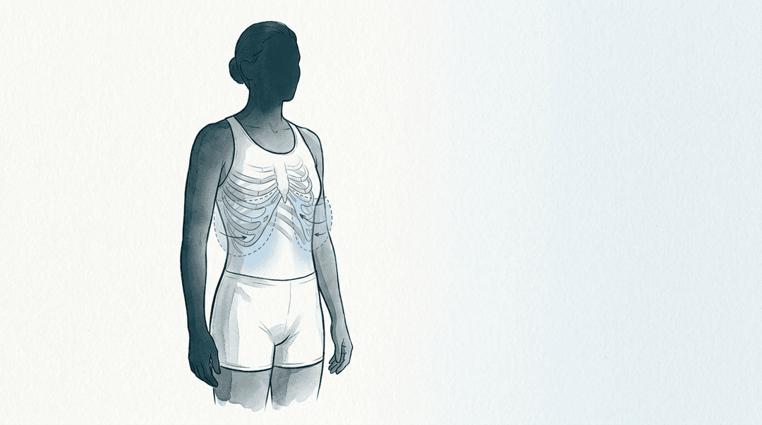 Illustrazione editoriale: disfunzione coste 7–9 bilaterali, espansione respiratoria ridotta nel nuotatore amatoriale