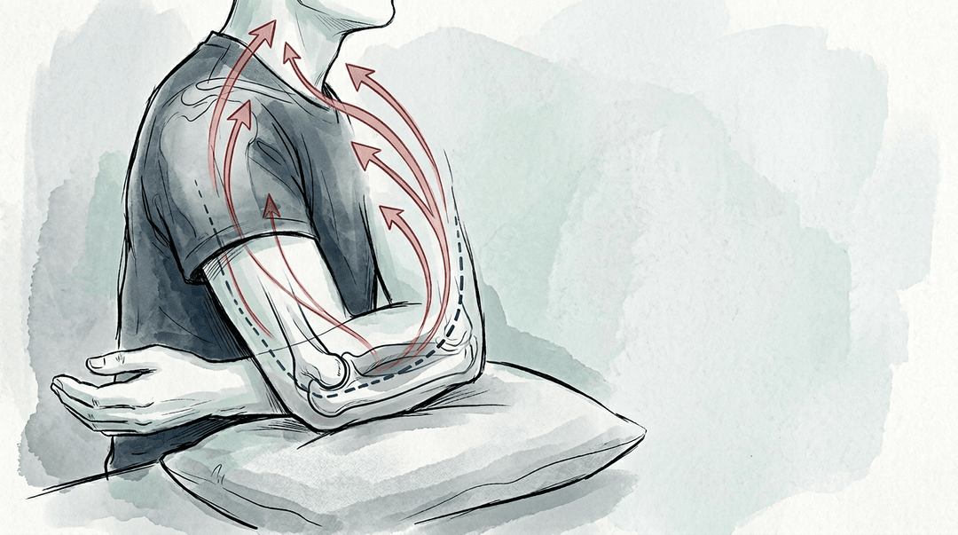 Illustrazione editoriale: sintomi ulnari da flessione protratta del gomito con tunnel cubitale e disfunzione cervico-scapolare