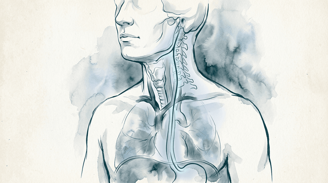 Illustrazione editoriale: nausea cronica funzionale con pattern cervico-vagale e rigidità della giunzione cranio-cervicale